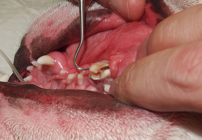 歯の破折（術前）