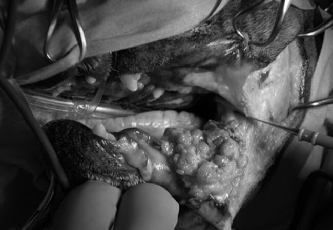 口腔内の腫瘍