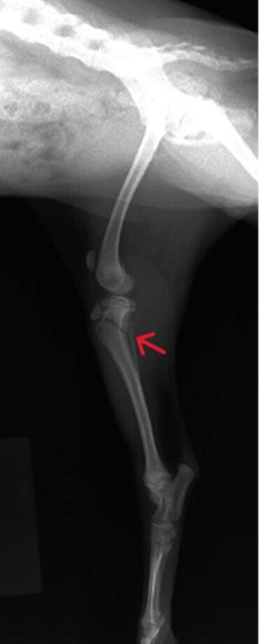 脛骨近位骨端板および近位骨幹部骨折（術前）