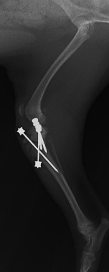 脛骨近位骨端板および近位骨幹部骨折（術後）